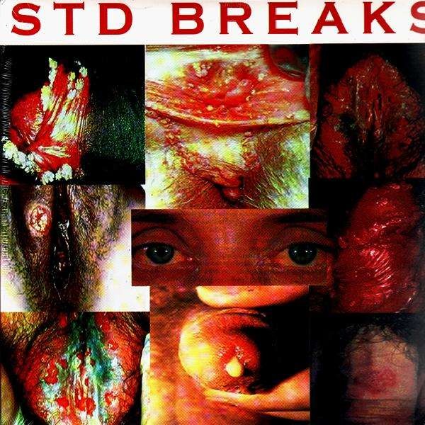 Std Breaks